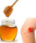 miel aplicada en heridas como curar con miel